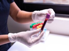 Laboratorní testy pro sportovce (2) – Jak správně načasovat testy a připravit se na ně