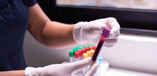 Laboratorní testy pro sportovce (2) – Jak správně načasovat testy a připravit se na ně